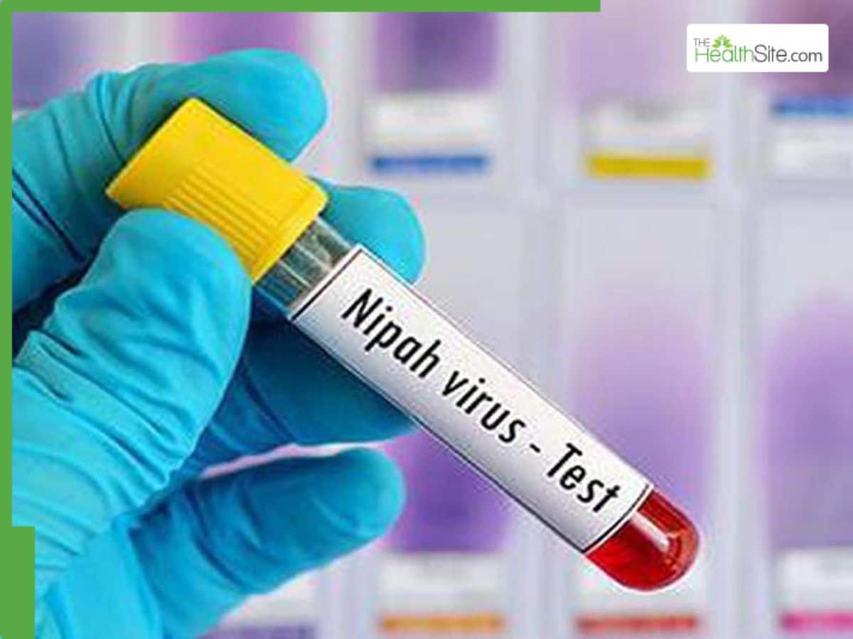Nipah Virus