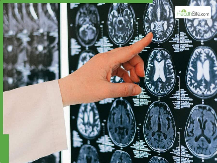 Parkinson's disease risk breakfast grains and cookies, study shows studies