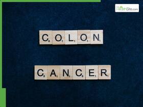 Why Is Colon Cancer Rising In Young Adults Under 50? All You Need To Know