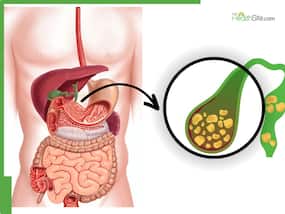 Gallbladder Patients: What Should You Eat And Avoid During Monsoon Season