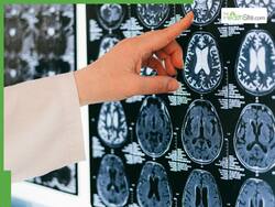 Common Cough Syrup Proven Safe To Treat Parkinson Disease Dementia