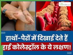 कोलेस्ट्रॉल बढ़ने पर हाथों-पैरों में दिखाई देते हैं ये 5 लक्षण, 90 फीसदी लोग साधारण समझकर करते हैं इग्नोर