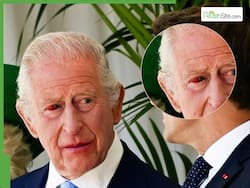 King Charles Health: Bloodspot Raises Fresh Concerns Over Monarch   s Wellbeing