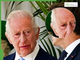 King Charles Health BIG Update: Is King Charles Dying? UK Monarch Receives Sympathy From US As Crisis Takes Toll On Health