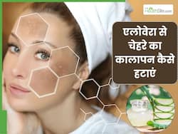 एलोवेरा से चेहरे का कालापन कैसे हटाएं? जानें 5 तरीके, जिनसे खिली उठेगी त्वचा और मिट जाएगी डार्कनेस