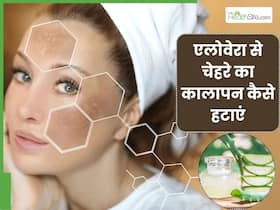 एलोवेरा से चेहरे का कालापन कैसे हटाएं? जानें 5 तरीके, जिनसे खिली उठेगी त्वचा और मिट जाएगी डार्कनेस