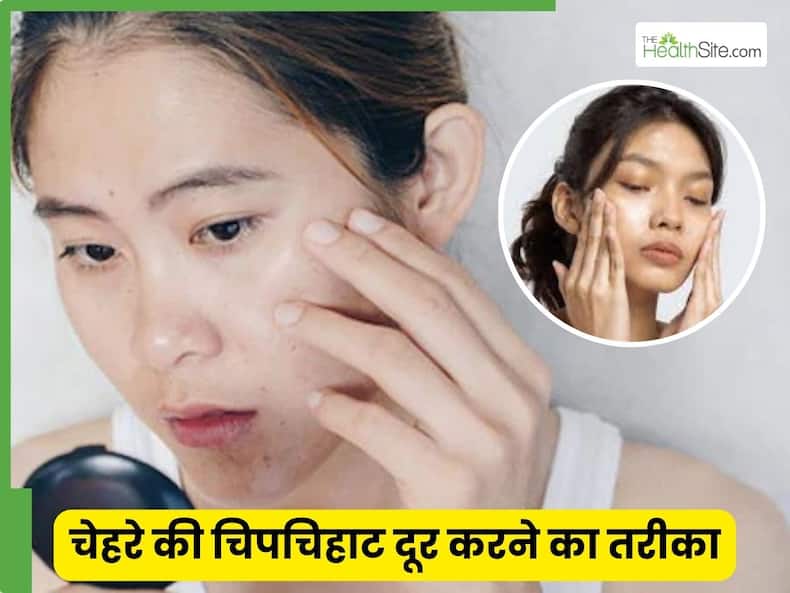 thehealthsite.com top news