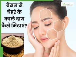 चेहरे के काले दाग मिटाने के लिए बेसन कैसे लगाएं? जानें 5 तरीके, जिनसे डार्क स्पॉट्स से मिलेगा छुटकारा