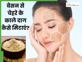 चेहरे के काले दाग मिटाने के लिए बेसन कैसे लगाएं? जानें 5 तरीके, जिनसे डार्क स्पॉट्स से मिलेगा छुटकारा
