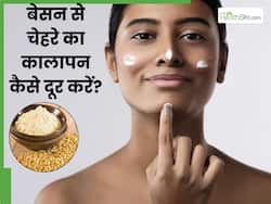 बेसन से चेहरे का कालापन कैसे हटाएं? जानें 5 तरीके, जिनसे मिट जाएंगे दाग-धब्बे और त्वचा का बढ़ेगा निखार