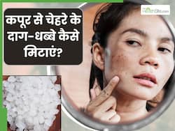 इस एक गोली से मिटाएं चेहरे के दाग-धब्बे और मुंहासे, इस्तेमाल करते ही त्वचा का बढ़ जाएगा चार गुना निखार