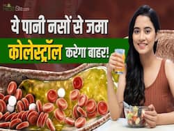 अदरक के पानी से करें कोलेस्ट्रॉल को कंट्रोल, नेचुरल तरीका LDL घटाने का