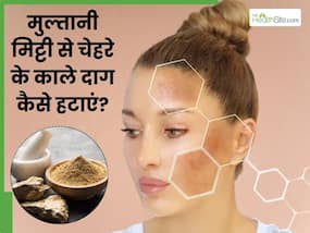 मुल्तानी मिट्टी से चेहरे के काले दाग कैसे हटाएं? जानें 5 तरीके, जिनसे मिट जाएंगे