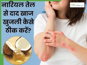 नारियल तेल से दाद खाज खुजली कैसे ठीक करें? इन 5 तरीकों से ठीक हो जाएगी समस्या