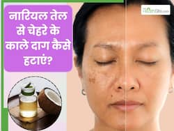 चेहरे के काले दाग हटाने के लिए नारियल तेल कैसे लगाएं? जानें 5 तरीके, जिनसे दूर होंगे दाग-धब्बे और झाइयां