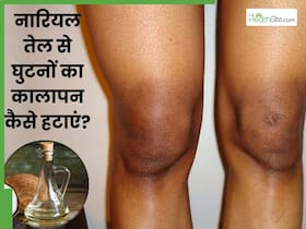 नारियल तेल से घुटनों का कालापन कैसे दूर करें? जानें 5 तरीके, जिनसे साफ हो जाएगी घुटनों की त्वचा नारियल तेल से घुटनों का कालापन कैसे दूर करें? जानें 5 तरीके, जिनसे साफ हो जाएगी घुटनों की त्वचा