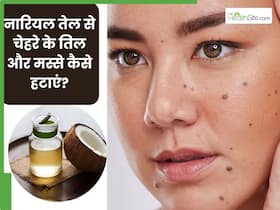नारियल तेल से चेहरे के तिल और मस्से कैसे हटाएं? जानें 5 तरीके, जिनसे निकल जाएंगे सारे काले तिल और मस्से