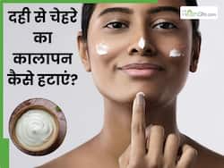 दही से चेहरे का कालापन कैसे हटाएं? इन 5 तरीकों से मिट जाएगी सारी डार्कनेस