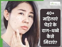 40+ महिलाएं चेहरे के दाग-धब्बे कैसे मिटाएं? जानें किन चीजों को लगाने से कम हो जाती है पिग्मेंटेशन