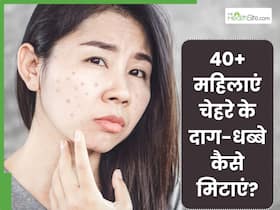 40+ महिलाएं चेहरे के दाग-धब्बे कैसे मिटाएं? जानें किन चीजों को लगाने से कम हो जाती है पिग्मेंटेशन