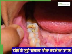 मसूड़ों पर नहीं लगेगा कीड़ा, दांत रहेंगे हमेशा सफेद, आजमाएं 1 घरेलू नुस्खा