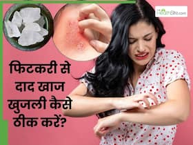 फिटकरी से दाद खाज और खुजली कैसे ठीक करें? जानें 5 तरीके, जिनसे जलन और खुजली से भी मिलेगी राहत