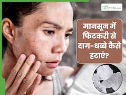 मानसून में फिटकरी से दूर करें काले धब्बे, इन 5 तरीकों से करें इस्तेमाल
