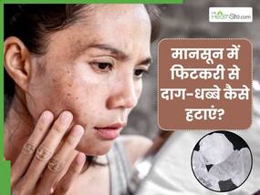 मानसून में फिटकरी से दूर करें काले धब्बे, इन 5 तरीकों से करें इस्तेमाल मानसून में फिटकरी से दूर करें काले धब्बे, इन 5 तरीकों से करें इस्तेमाल