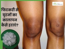 फिटकरी से घुटनों का कालापन कैसे हटाएं? जानें 5 उपाय, जिनसे साफ हो जाएंगे घुटने फिटकरी से घुटनों का कालापन कैसे हटाएं? जानें 5 उपाय, जिनसे साफ हो जाएंगे घुटने