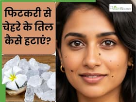 फिटकरी से चेहरे के तिल कैसे हटाएं? जानें 5 तरीके, जिनसे निकल जाएंगे तिल और काले मस्से