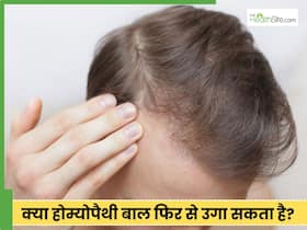 होम्योपैथी में छिपा है बाल उगाने का राज, कैसे? डॉक्टर से जानें