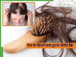 Hair Fall: रोजाना कितने बाल टूटना नॉर्मल है, कहीं आप बिना बात तो नहीं कर रहे चिंता?