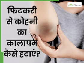 फिटकरी से कोहनी का कालापन कैसे साफ करें? 1 नुस्खा देगा चमकदार त्वचा
