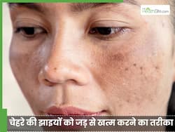 एलोवेरा जेल से चेहरे की झाइयां कैसे हटाएं? एक्सपर्ट के बताए तरीके से साफ-चिकना हो जाएगी स्किन