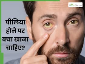 पीलिया होने पर इन 5 चीजों का करें सेवन, त्वचा और आंखों का पीलापन होगा कम