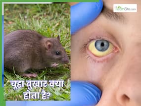 बड़ा खतरनाक है 'चूहा बुखार', जानें कारण, लक्षण और उपचार बड़ा खतरनाक है 'चूहा बुखार', जानें कारण, लक्षण और उपचार