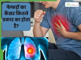 फेफड़ों के कैंसर कितने प्रकार के होते हैं? जानें कौन-सा कैंसर है सबसे खतरनाक