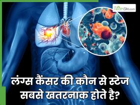 लंग्स कैंसर की कौन से स्टेज सबसे खतरनाक होते है? कैसे पता चलेगा कि कैंसर किस स्टेज में है?
