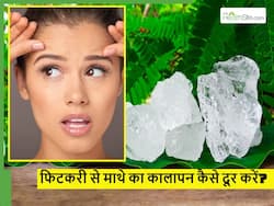 Fitkari से माथे का कालापन कैसे दूर करें? धूप के कारण आपका माथा भी पड़ गया काला, तो ऐसे इस्तेमाल करें फिटकरी