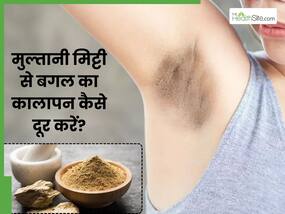 मुल्तानी मिट्टी से बगल का कालापन कैसे दूर करें? जानें 5 तरीके, जिनसे कांख हो जाएगी पूरी तरह साफ