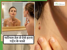 नारियल तेल में क्या मिलाकर गर्दन के मस्से हटाएं? बिना लेजर के मिलेगा अनचाहे मस्सों से छुटकारा