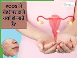 PCOS में चेहरे पर दाने क्यों हो जाते हैं? जानें इसके कारण और बचाव के उपाय