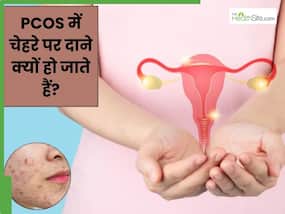PCOS में चेहरे पर दाने क्यों हो जाते हैं? जानें इसके कारण और बचाव के उपाय