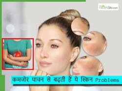 बार-बार चेहरे पर पिम्पल्स क्यों होते हैं? पेट से जुड़ी हो सकती है ये परेशानी, जानिए डाइजेशन और स्किन के बीच का कनेक्शन