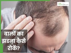 40 की उम्र में बालों को घना कैसे करें? ये 5 आदतें कर रही हैं आपको गंजा