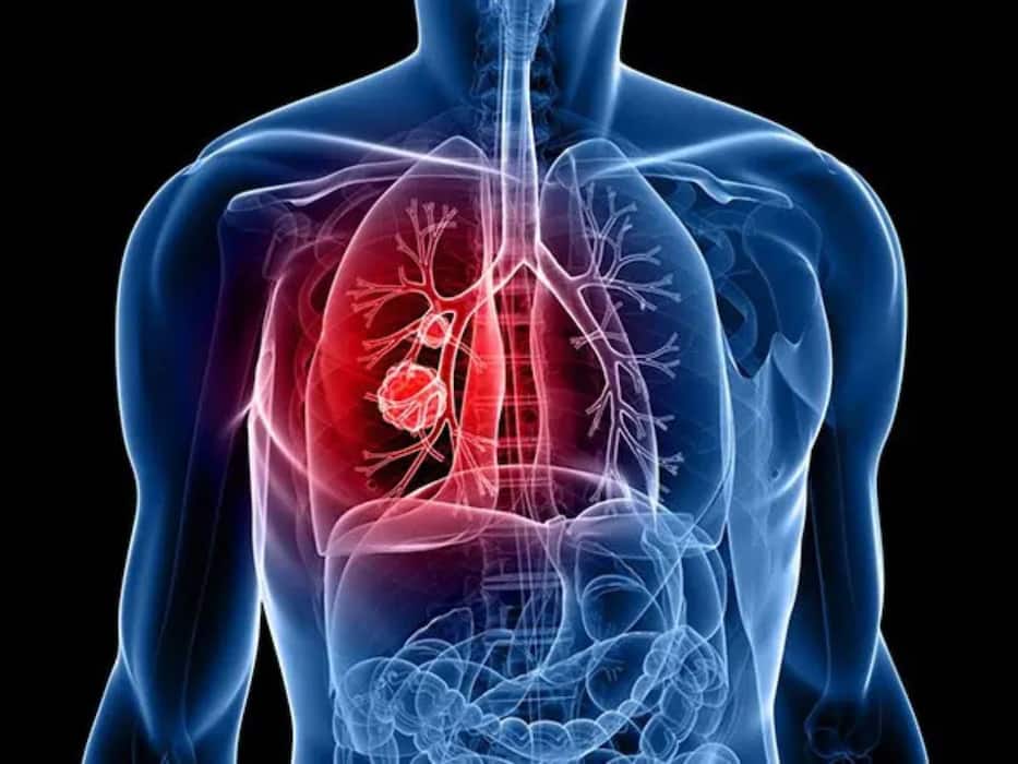 खुली हवा में घुटन महसूस क्यों होती है? इन 5 बीमारियों का हो सकता है संकेत