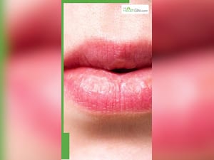 5 Best Ways To Deal With Chapped Lips