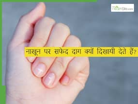 नाखूनों पर सफेद धब्बे क्यों दिखते हैं? इन न्यूट्रिएंट्स की कमी होते ही नाखून होने लगते हैं खराब