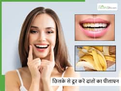 अच्छी तरह ब्रश करने के बाद भी दांत हैं पीले तो आज से ही ट्राई करें ये 1 उपाय, पहली बार में चमक उठेंगे दांत