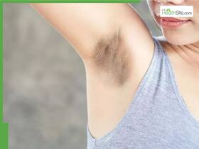 5 Effective Home Remedies to Lighten Dark Underarms Naturally